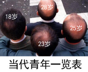 28岁18岁25岁23岁当代青年一览表(秃头)_18_23_25_28_秃头表情